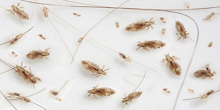 What Do Baby Lice Look Like? - Classified Mom